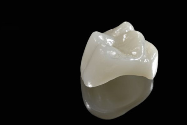 When Would A Dentist Recommend CEREC?