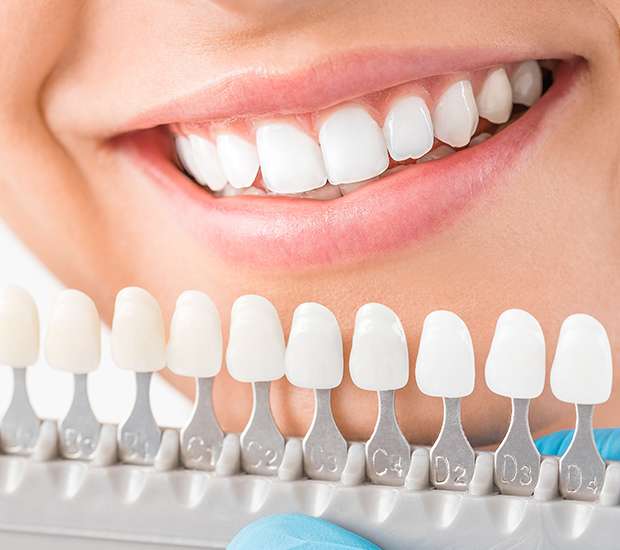 Brevard Cosmetic Dentist