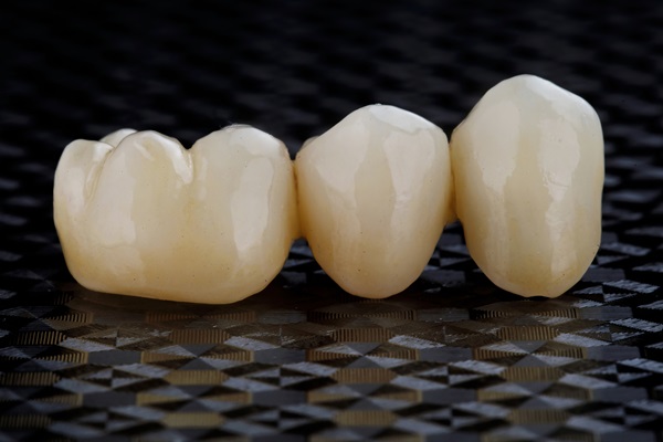 How To Tell If You Are A Candidate For A Dental Bridge