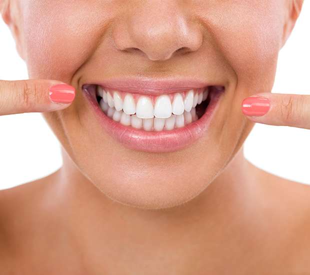 Brevard What Is Gum Contouring & Reshaping