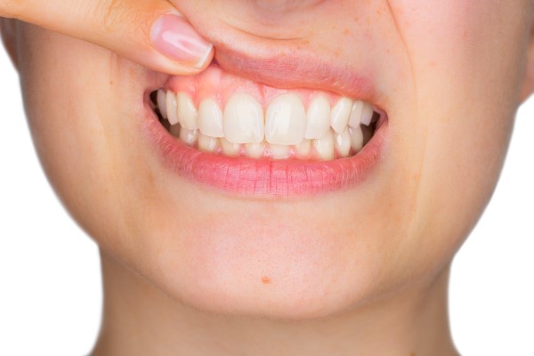 Routine Dental Checkups Can Help Prevent Gum Disease