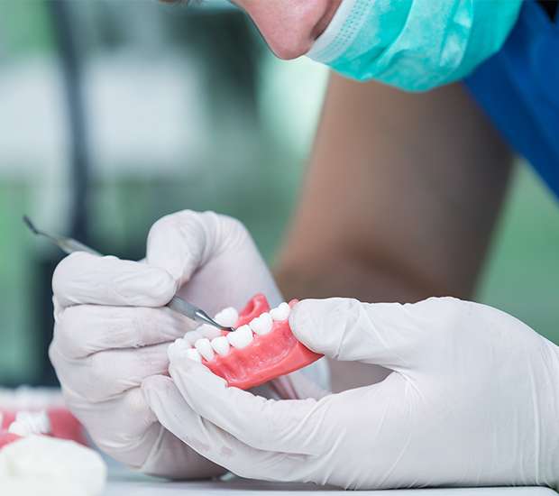 Brevard Partial Denture for One Missing Tooth
