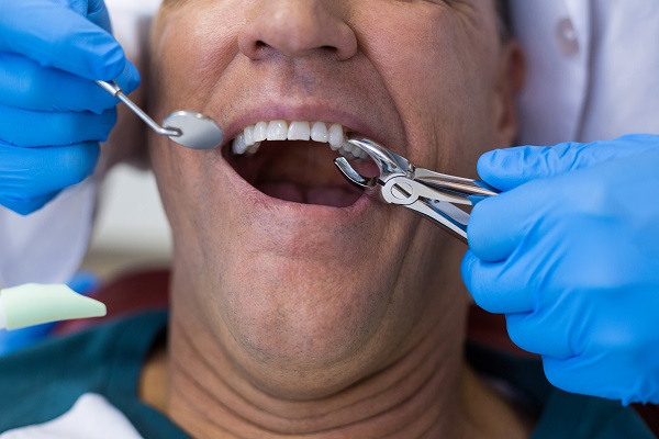 When A Dental Emergency May Require Tooth Extractions