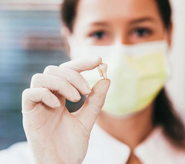 Brevard Tooth Extraction